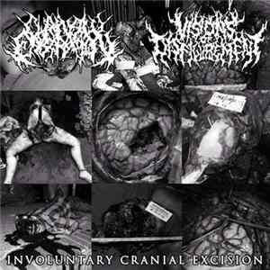 Chainsaw Castration / Visions Of Disfigurement - Involuntary Cranial Excision FLAC
