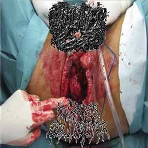RxMxLxBxBxCx / Ovaries Collector - Split FLAC