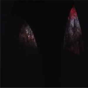 Mould - M2=oh Autumn Sessions FLAC