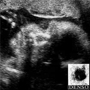 DENSO - 090515 / Aglaia FLAC