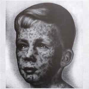 Various - Fever FLAC