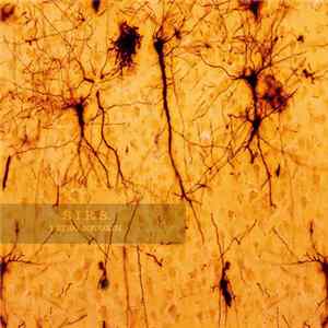 Systemic Inflammatory Response Syndrome - Tetrodotoxin Single 2017 FLAC