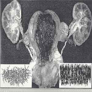 Vesicoureteral Reflux / Clogged Urethra - Untitled FLAC