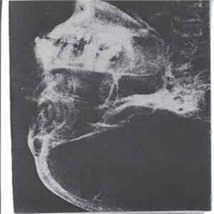 Attrition / The Dangerous Brothers / Stress / Megaton - Double Vision FLAC