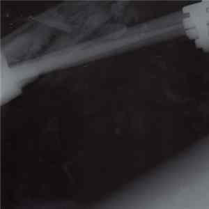 The Broken Human Machine - X-Ray FLAC