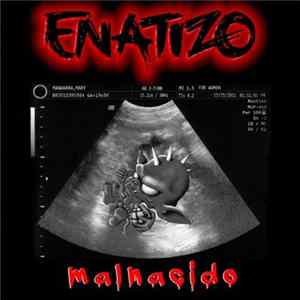 Enatizo - Malnacido FLAC
