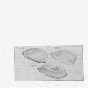 Schlemiel - Pessarium FLAC