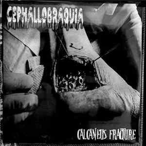 Cephallobraquia - Calcaneus Fracture FLAC