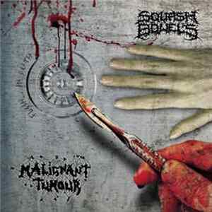 Malignant Tumour / Squash Bowels - Flesh... In Death FLAC