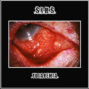 Systemic Inflammatory Response Syndrome - Tularemia FLAC