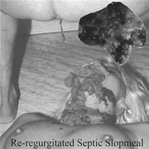 SxCxAxTx - Re-regurgitated Septic Slopmeal FLAC