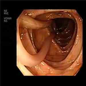 Nerve Vitamins - Good Colonoscopy FLAC